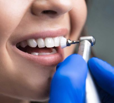 monDent_Duesseldorf_Website_Behandlung_weisses_laecheln_2